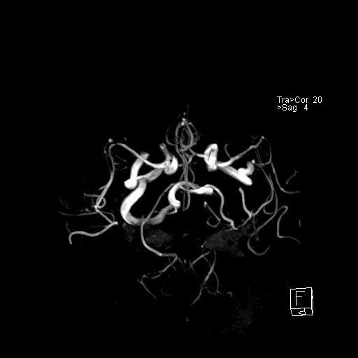 Click on the Serie image to view the images of VILLANUEVA, WILLIAM A.